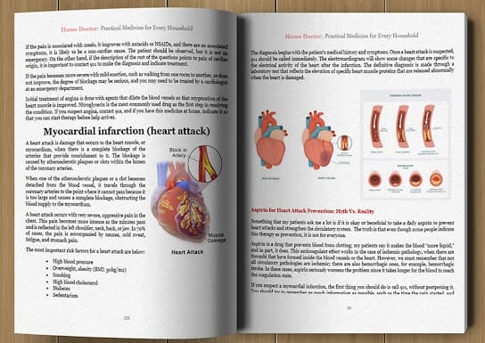 The Home Doctor Book Heart Symptoms Guide